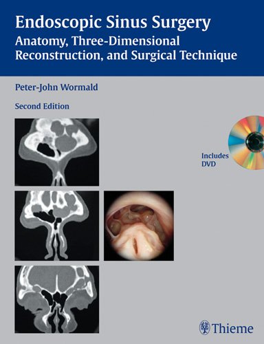 Endoscopic Sinus Surgery: Anatomy, Three-Dimensional Reconstruction, and Surgical Technique Ebook