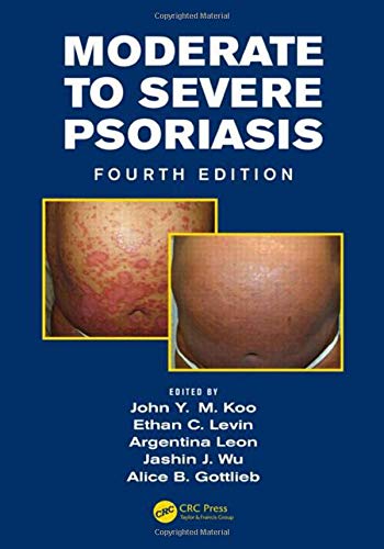 Mild to Moderate and Moderate to Severe Psoriasis (Set) Ebook