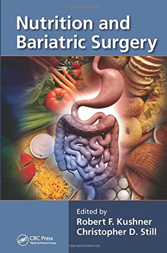 Nutrition and Bariatric Surgery Ebook