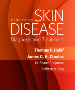 Skin Disease: Diagnosis and Treatment